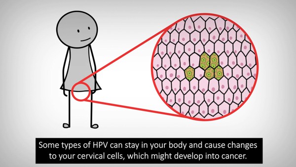 Screengrab of animation showing how cells can change when you have HPV.